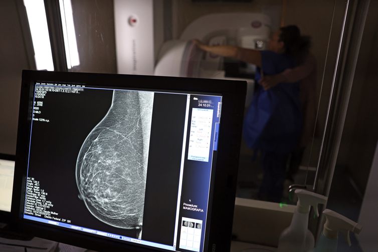 José Cruz/Agência Brasil Brasília (DF), 01/10/2024 - Teste de mamografia realizado na Campanha Outubro Rosa: Sesc-DF, que oferece exames e consultas gratuitas às mulheres. Foto: José Cruz/Agência Brasil