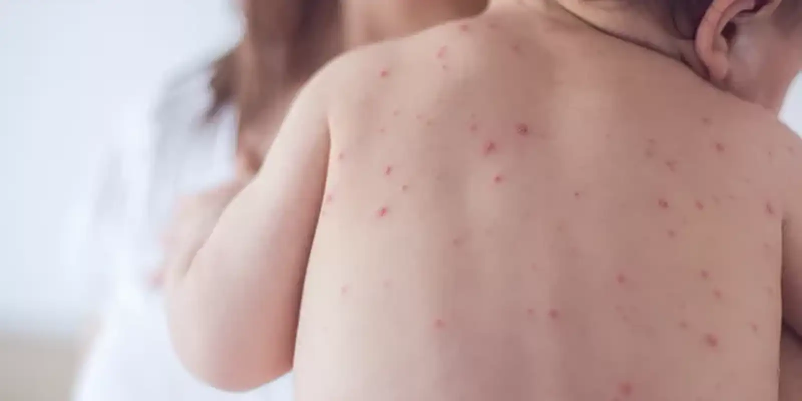 Estado de São Paulo reforça necessidade de vacinação contra o